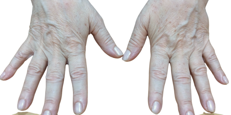Bioestimuladores harmonizacao coporal (1)